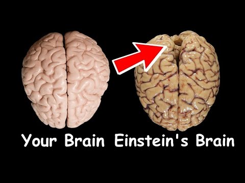 How Albert Einstein's Brain Was Different From A Normal Human Brain ...