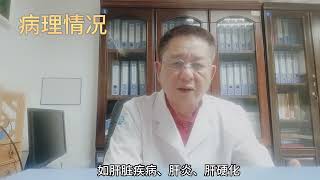 肿瘤筛查，血清铁蛋白升高，体内一定存在肿瘤吗？ #健康 #医学 #知识