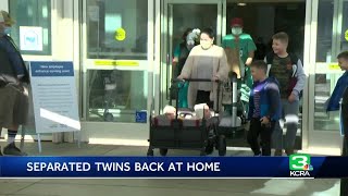 Previously conjoined Sacramento twins head home