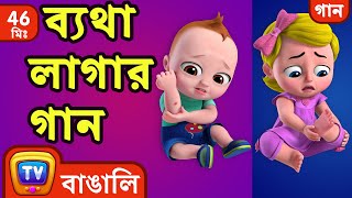 ব্যথা লাগার গান (The Boo Boo Song) + More Bangla Rhymes for Children - ChuChu TV