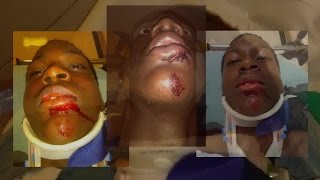 Student says he was beaten by teacher at charter school