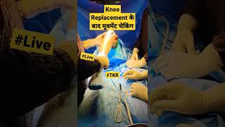 Knee Replacement के बाद घुटने के movement ki चेकिंग | #totalkneereplacementsurgery #kneesurgery #tkr