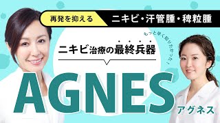 再発を抑えるニキビ治療！アグネス｜セイコメディカル｜稗粒腫・汗管腫にも | Doctors discussing Agnes, permanent treatment for chronic acne