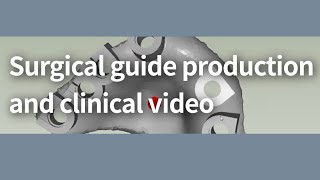 Surgical guide production and clinical video(ENG)