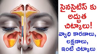 సైనసైటిస్ కు ఇంటి చిట్కాలు | Home Remedies for Sinusitis | Health Tips || TeluguISM