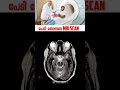 mri scan ലെ പേടിപ്പിക്കുന്ന ചിത്രങ്ങൾ do you know