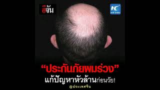 มีจริงๆ! บริษัทจีนเปิดตัว “ประกันภัยผมร่วง” หลังปัจจุบันคนหนุ่มสาวเสี่ยงหัวล้านเร็วขึ้น อ่านข่าวต่อ