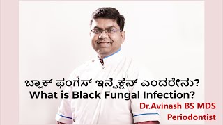 ಬ್ಲಾಕ್ ಫಂಗಸ್ ಇನ್ಫೆಕ್ಷನ್ ಎಂದರೇನು? What is Black Fungal Infection?