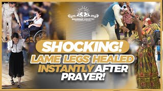 HEALING MINISTRY: SHOCKING! LAME LEGS HEALED INSTANTLY AFTER PRAYER