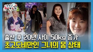 [건강한 家] 출산 후 20년 사이 50kg 증가...초고도비만인 그녀의 몸 상태