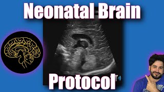 Neonatal Brain Protocol