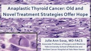 Anaplastic Thyroid Cancer Sosa and Tuttle 07292011