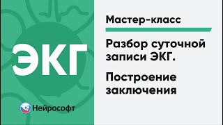 Разбор суточной записи ЭКГ. Построение заключения | Мастер-класс