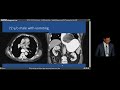 Solid Organ and GI Torsion in the ER | Free Radiology CME