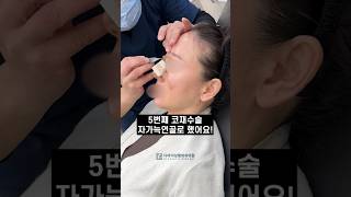 자가늑연골로 5번째 코재수술 성공!  #shorts #자가늑연골 #코재수술 #鼻手術