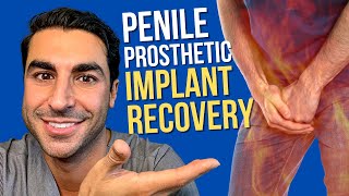 What is the Recovery after Penile Prosthesis Implant Surgery | Los Angeles Surgeon Justin Houman MD
