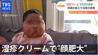 抗菌クリームで乳児の顔肥大疑惑  中国で批判殺到【Nスタ】