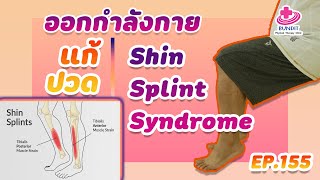 ออกกำลังกายแก้ปวด Shin Splint Syndrome | กายภาพง่ายๆกับบัณฑิต EP.155