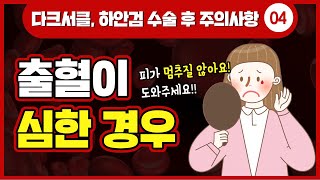 [대전 어울림성형외과] 하안검 다크서클 수술 후 출혈이 심하다면?