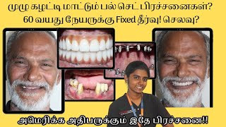 60 வயதில் முழு Fixed பல் செட் Implant மூலம்! முழு செலவு மற்றும் செயல்முறை விளக்கம்!