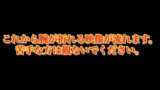 ※閲覧注意。腕が折れます。