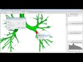 Tutorial: Mimics Innovation Suite - Segment Airway QUICKLY