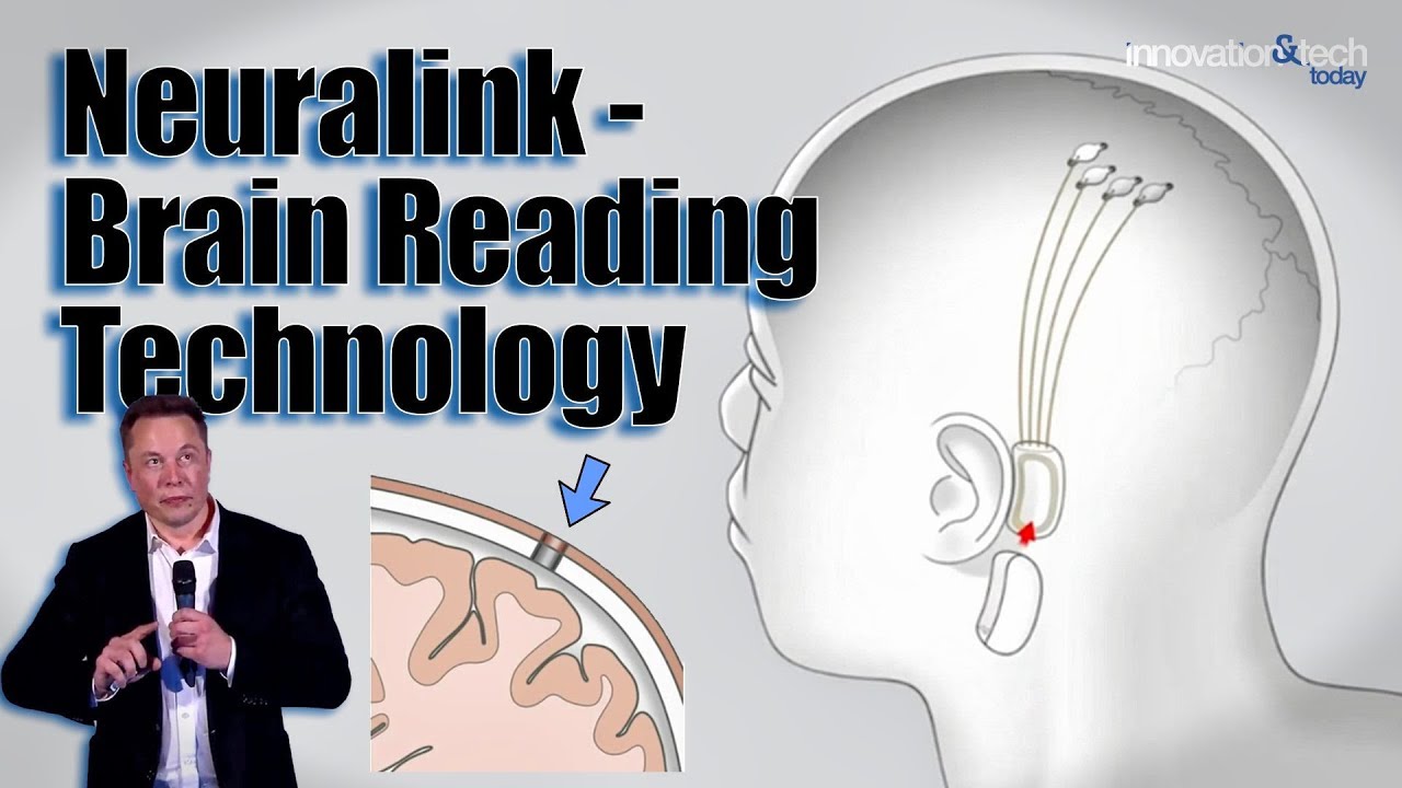 Elon Musk's Neuralink - Brain Reading Technology - Quick Bytes - YouTube