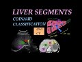 LIVER SEGMENTS RADIOANATOMY - Coinaud classification l Segment identification on USG and CT scan l