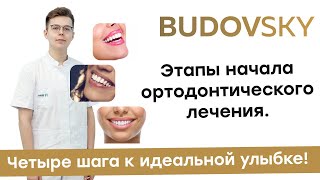 С чего начать лечение зубов? Этапы лечения у врача ортодонта. Четыре шага к идеальной улыбке!