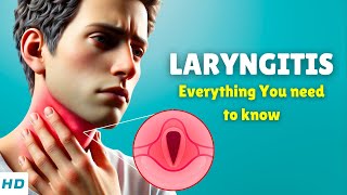 Laryngitis (Losing Your Voice) – Causes, Signs and Symptoms, Diagnosis & Treatment