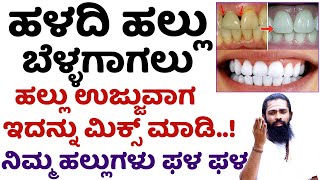 ಹಲ್ಲುಗಳು ಬೆಳ್ಳಗಾಗಲು ಸಿಂಪಲ್ ಮನೆಮದ್ದು | Whiten Your Teeth at Home in Kannada | Hallina Kale Hogalu