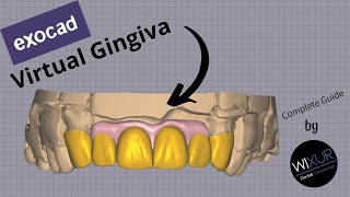 How to Design A Virtual Gingiva