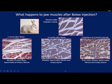 How does Botox cause muscle paralysis?