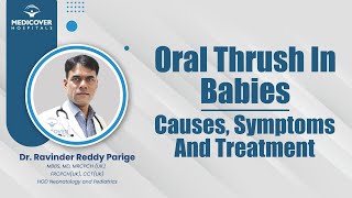 Oral Thrush In Babies: Causes, Symptoms And Treatment | Medicover Hospitals