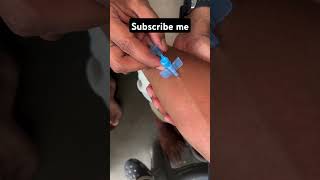 IV Cannula Insertion how To Insert IV Cannula #doctor #mbbs #youtubeshorts #ytshorts #neet #viral