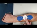 saebostim one set up tips for a hairy arm