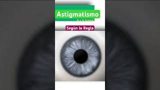 Astigmatismo según la Regla.