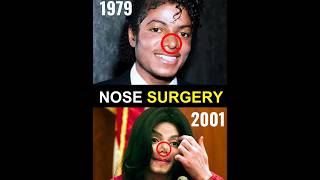 How Micheal Jackson Surgery went wrong ❌ #dance #viral #mystery