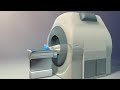 Magnetic Resonance Imaging (MRI)