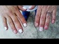 Woman's 50-Year Nail Biting Habit Is Ruining Her Life Woman's 50-Year Nail Biting Habit Is Ruining Her Life