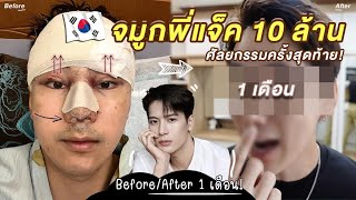 Ep.4 เส้นทางสู่ Jackson Wang 🇰🇷 จมูกพี่แจ๊ค 10 ล้านวอน + เปิดหน้าครบ 1 เดือน เจ็บนี้มันคุ้ม!!