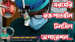 টনসিল অপারেশনের(Tonsillectomy) ভিডিও সরাসরি ❓