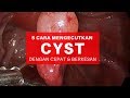 5 Cara Hilangkan Cyst Dengan Cepat Dan Paling Selamat. Kecut Hanya 2 Minggu