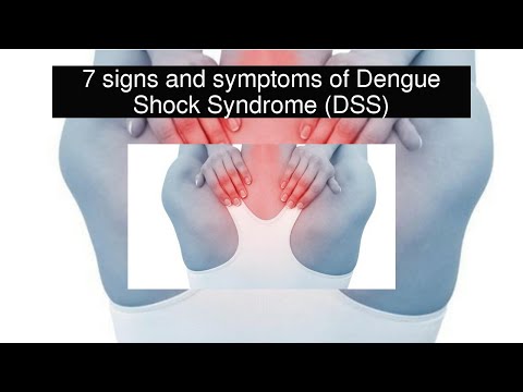 7 signs and symptoms of Dengue Shock Syndrome (DSS) 7 signs and symptoms of Dengue Shock Syndrome (DSS)