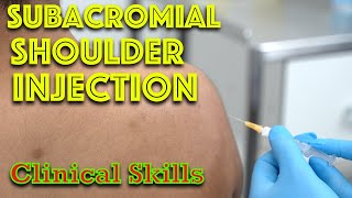 How To Perform A Steroid Shoulder Injection - Subacromial injection - Clinical Skills - Dr Gill