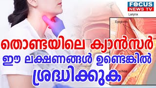 തൊണ്ടയിലെ ക്യാൻസർ ;ഈ ലക്ഷണങ്ങൾ ഉണ്ടെങ്കിൽ ശ്രദ്ധിക്കുക