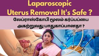 Laparoscopic Uterus Removal!! IsIt Safe ? லேப்ராஸ்கோபி மூலம் கர்ப்பப்பை அகற்றுவது பாதுகாப்பானதா ?