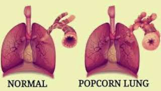 Escape the Vape - Popcorn Lung