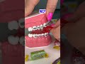 FREEZE DRIED CANDY VS BRACES 🦷 ORTHODONTIST REACTS WILL IS BREAK BRACES OFF? FOOD ASMR CRUNCH TEETH