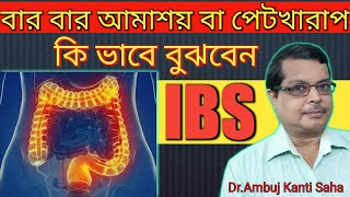 How to cure Irritable Bowel Syndrome permanently | IBS Homeopathic treatment with symptoms in Bangla